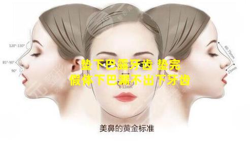 垫下巴露牙齿 垫完假体下巴漏不出下牙齿